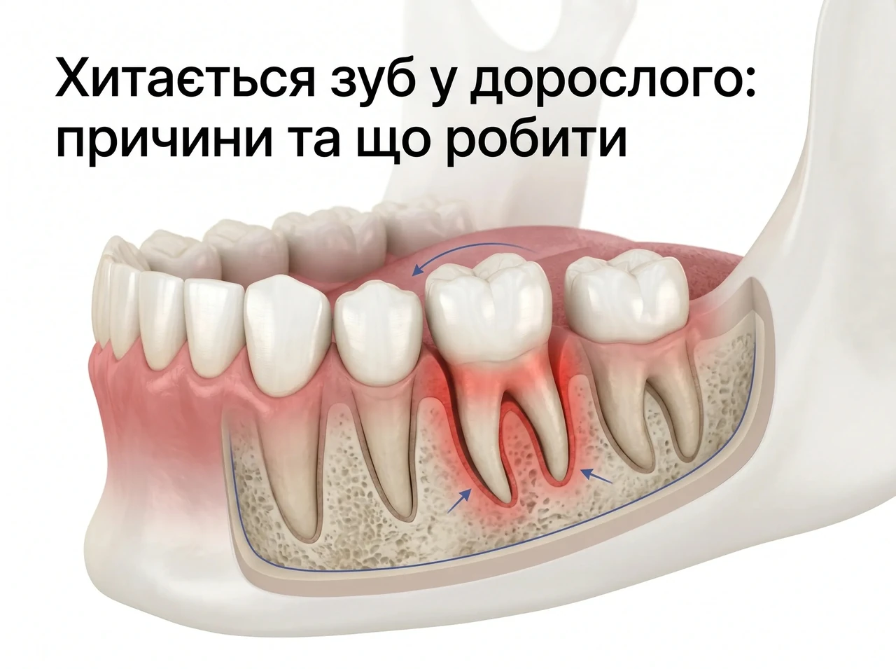 Чому хитаються зуби: причини і що робити одразу